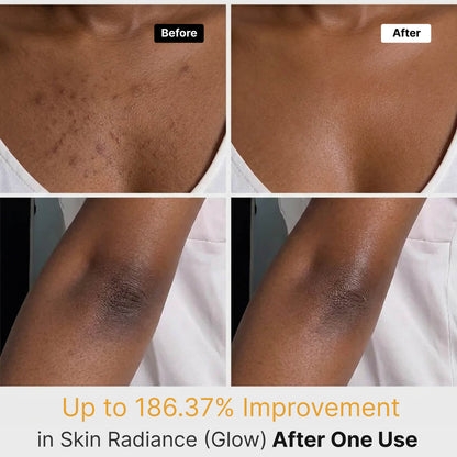 Kojic Acid Turmeric Body Spray