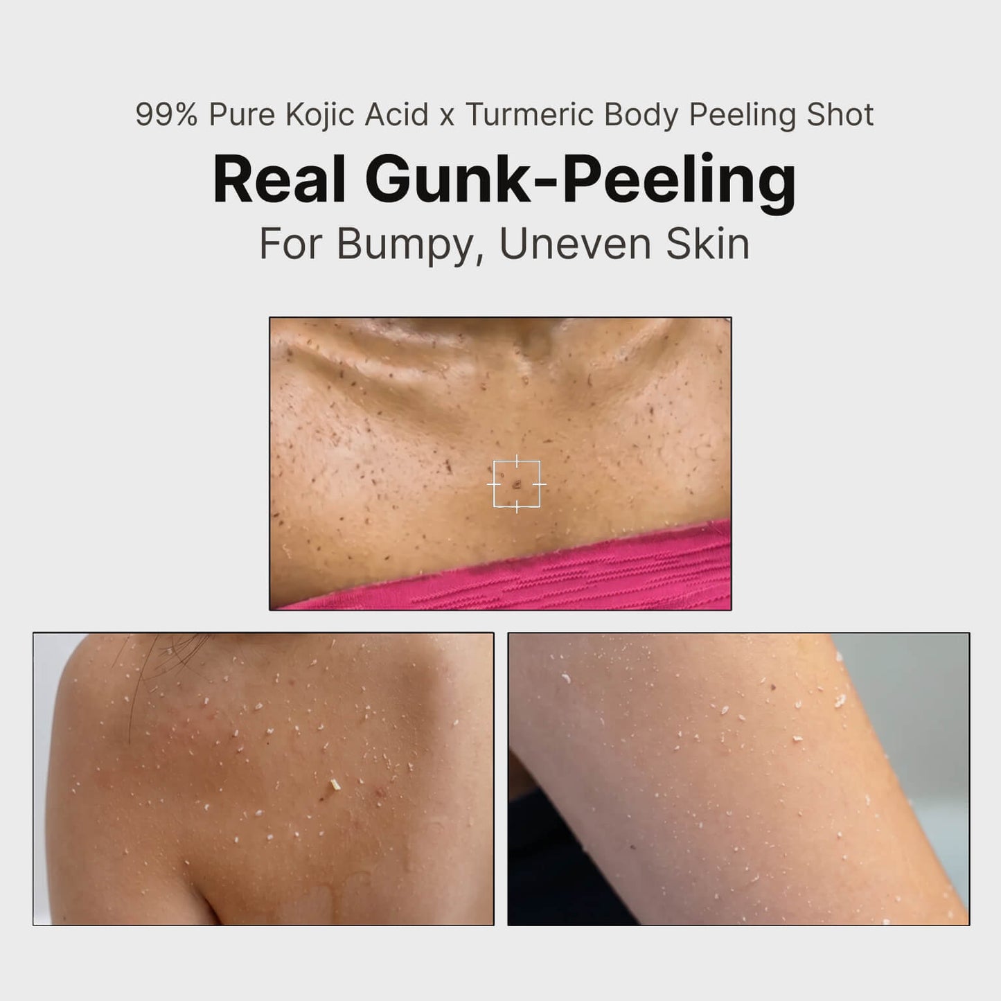 Kojic Acid Turmeric Body Spray