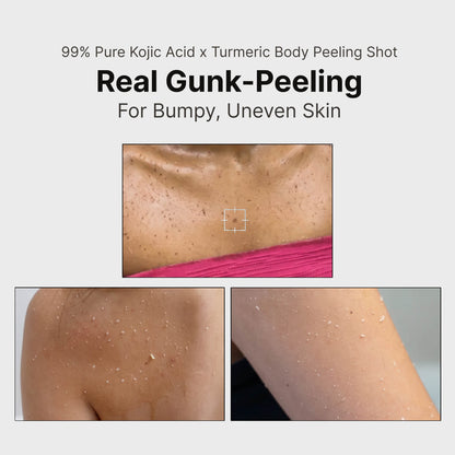 Kojic Acid Turmeric Body Spray